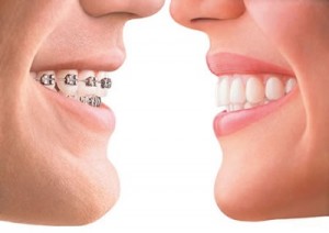 braces orthodontist